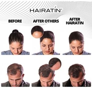 Hair building fibers for hair lost.